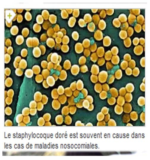 Staphylocoque doré