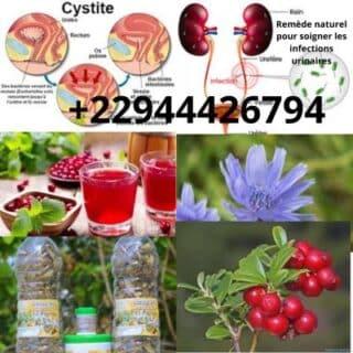 Comment soigner la cystite? Remède naturel