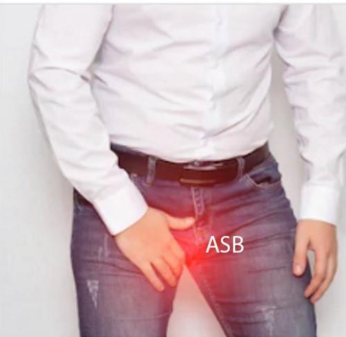 Homme avec Varicocèle, Meilleur Remède Naturel Varicocèle