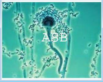 Aspergillose afrique bio