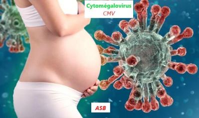 Cmv grossesse asb Traitement Naturel Virus Zika