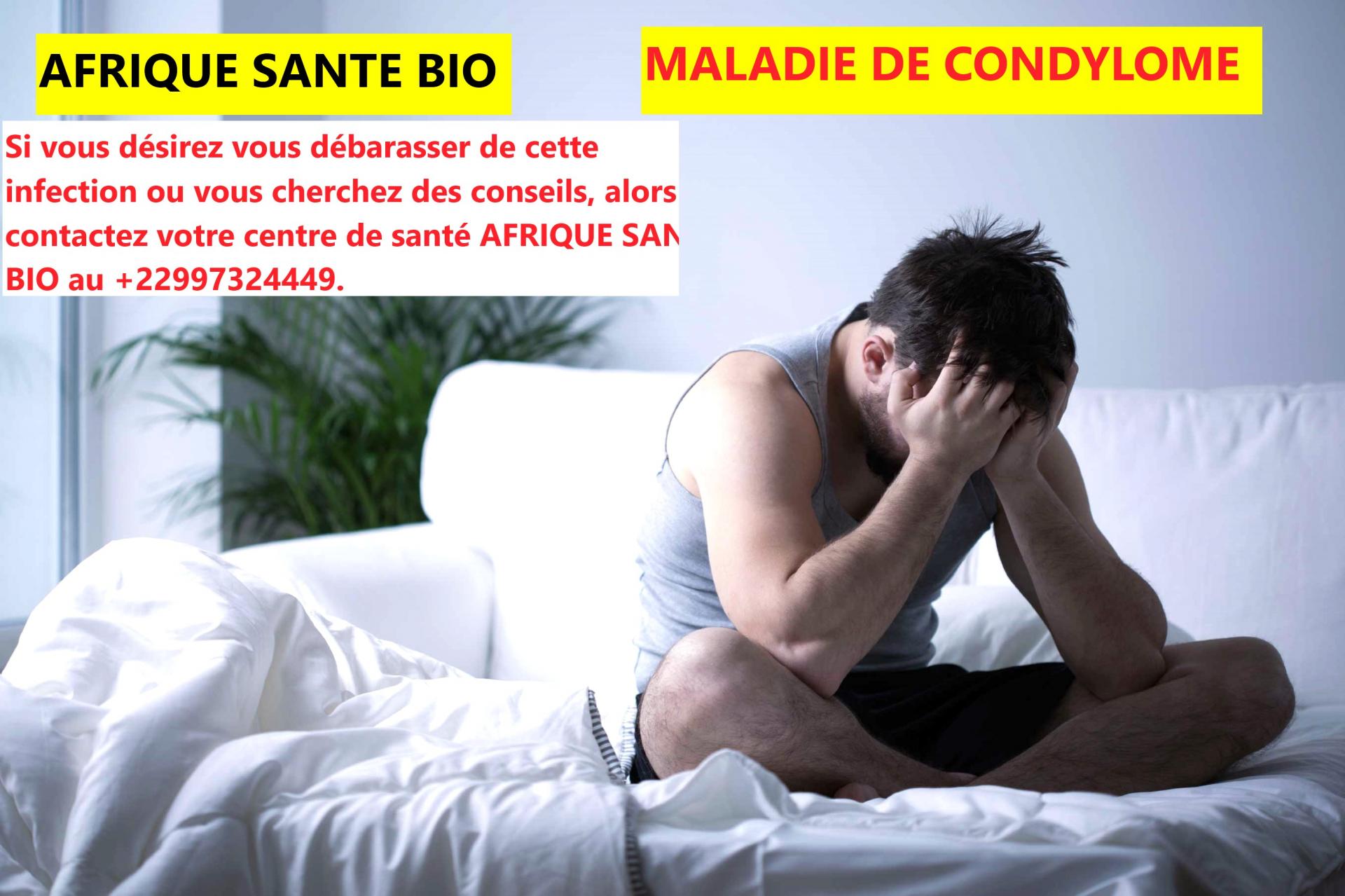Condylome titre asb