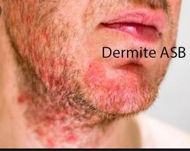 Dermite afrique bio afc