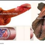 Erection forte