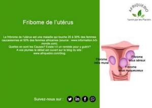 Fibrome et myomes utérins, Remède Naturel Myome