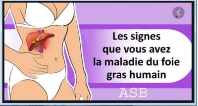 Foie  Humain Pathologies du Foie Tisane pour le Foie