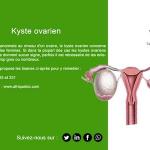 Kyste ovarien