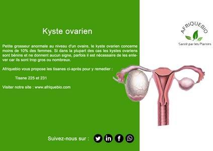 Kyste ovarien