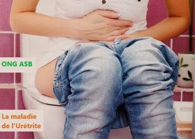 Maladie de urétrite Cystite Infection urinaire