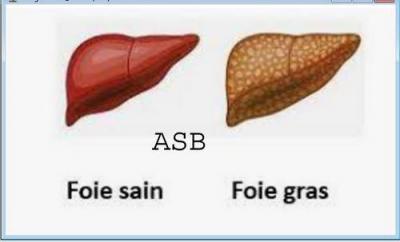 Maladie foie Remède naturel maladies du Foie