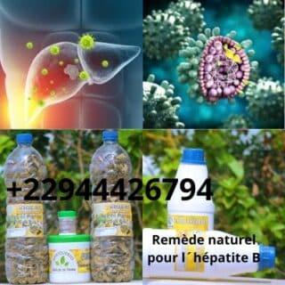 Comment soigner l´Hépatite B? Traitement 100 % naturel