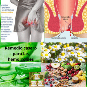 Hemorroides: remedio casero para las hemorroides