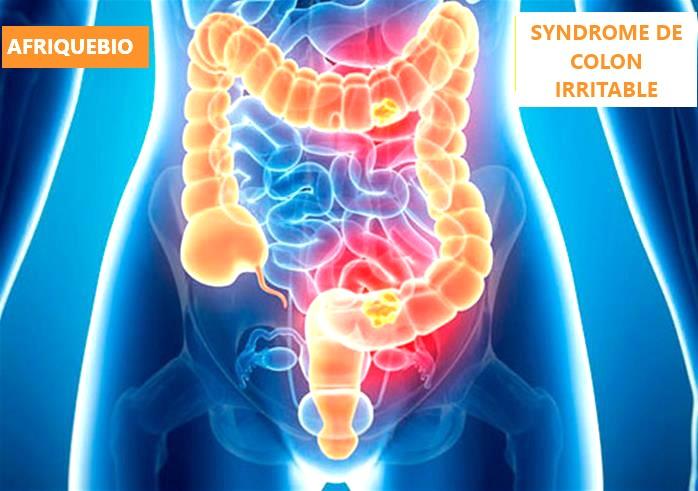 Syndrome de colon asb