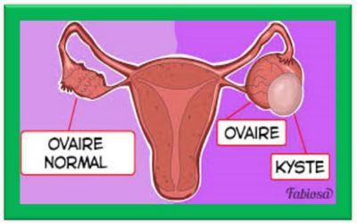 Traitement kyste ovarien:Rose de Jéricho Bienfaits