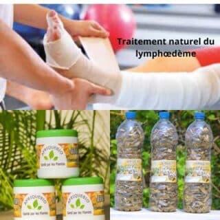 ¿Cómo tratar el linfedema?: Tratamiento 100% Natural