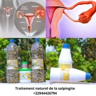 Comment soigner la Salpingite et tomber enceinte?