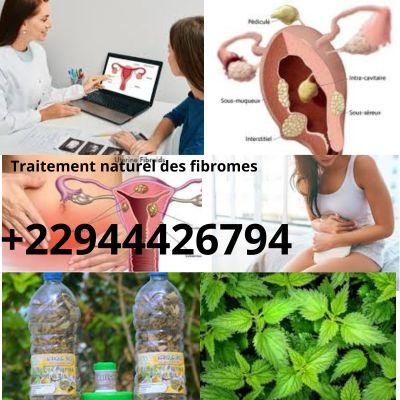 Soigner les myomes, fibromes: Traitement 100 % Naturel