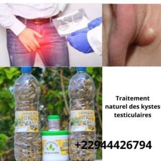 Comment soigner le kyste testiculaire sans chirurgie ?