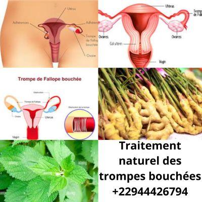 Déboucher les trompes au Cameroun? Traitement naturel