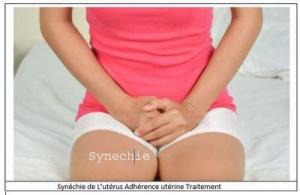 Traitement synéchie pour Avoir Bébé Naturellement