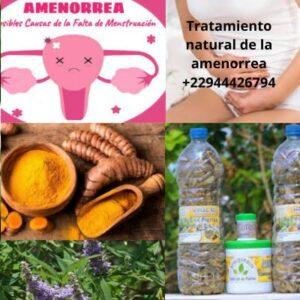 Tratamiento natural de la amenorrea 22944426794 300x300