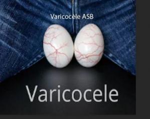 Varice des testicules Varicocèle Traitement Plantes