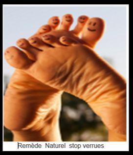 Verrue de pieds, Remède Naturel Verrue