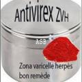 Zona varicelle